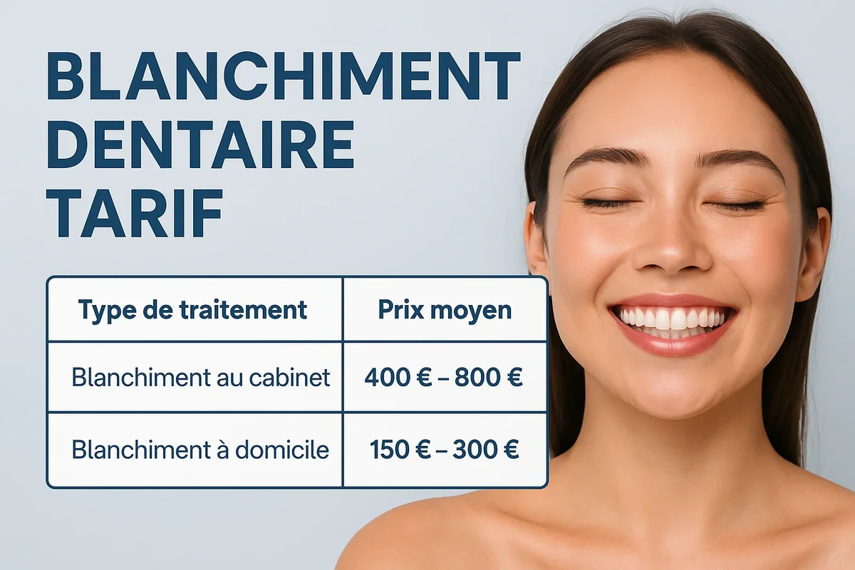 đŠ· Blanchiment dentaire tarif : tout savoir avant de se lancer 5 blanchiment dentaire tarif