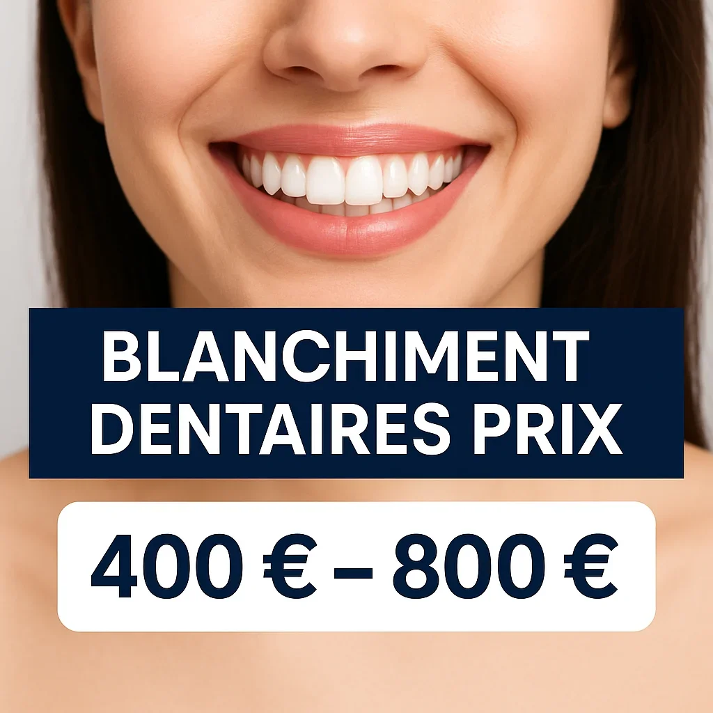 Blanchiment dentaires prix : tout savoir avant de se lancer 5 blanchiment dentaires prix