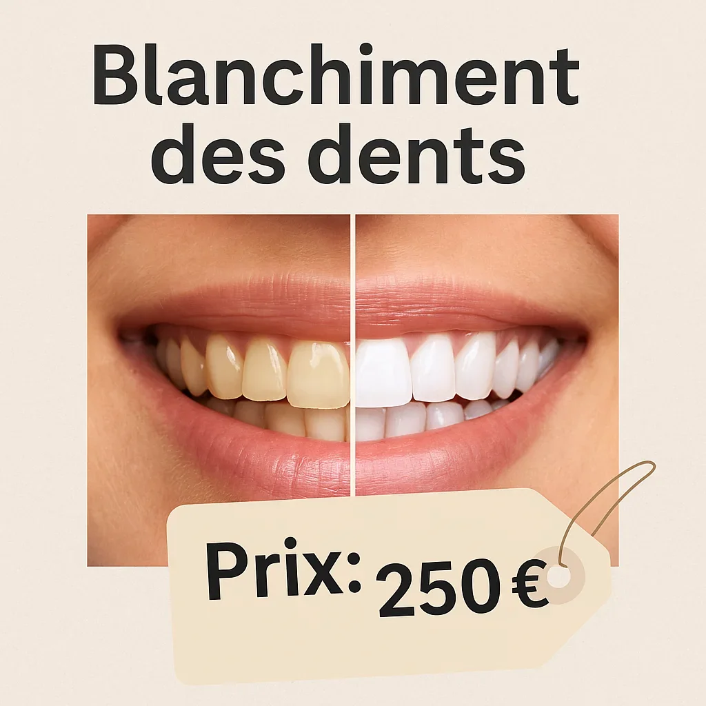 Blanchiment des dents prix : tout ce qu’il faut savoir 5 blanchiment des dents prix