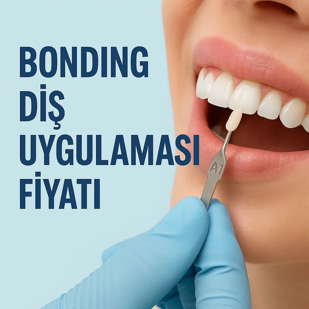 Bonding Diş Uygulaması Fiyatı 2025: Estetik Gülüş İçin Kapsamlı Rehber 5 bonding dis uygulamasi fiyati