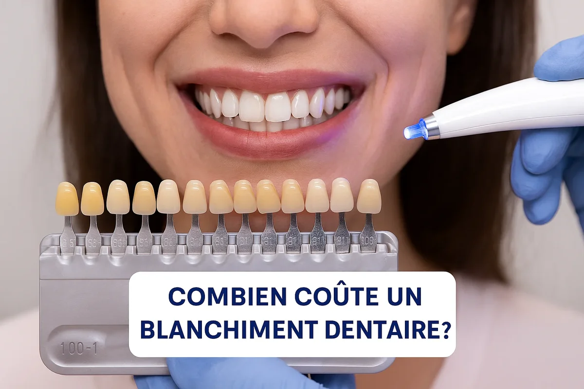 Combien coûte un blanchiment dentaire ? Guide complet 2025 5 combien coute un blanchiment dentaire