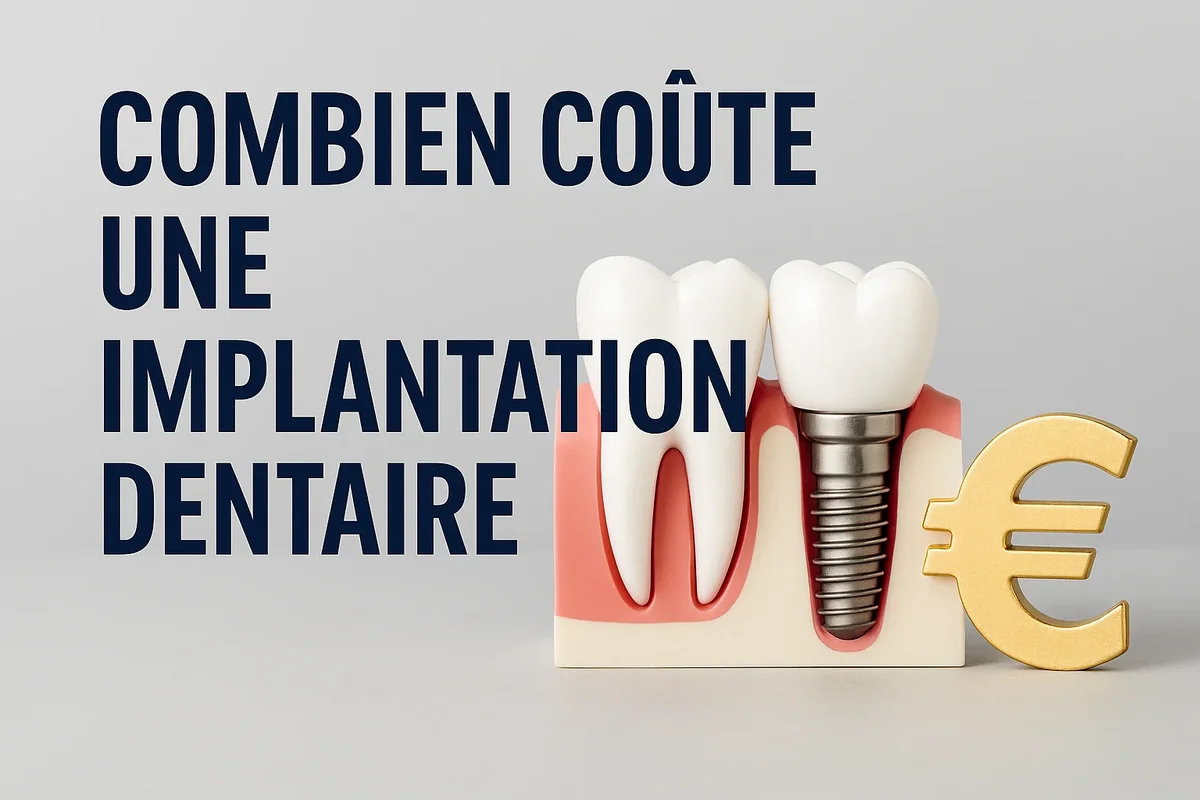 Combien coûte une implantation dentaire : guide complet 2025 5 combien coute une implantation dentaire