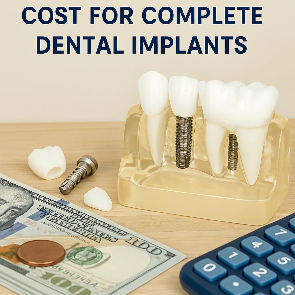 Understanding the Cost for Complete Dental Implants 5 cost for complete dental implants