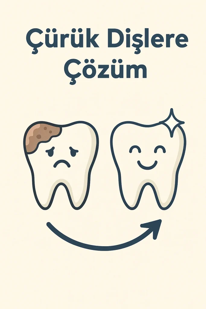 Çürük Dişlere Çözüm: En Etkili Yöntemler 4 curuk dislere cozum
