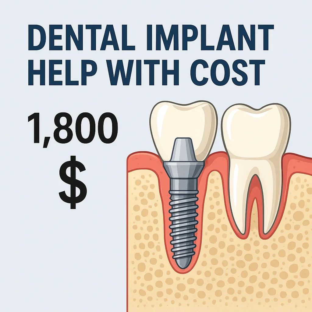 Dental Implant Help with Cost: Affordable Solutions for Your Smile 5 dental implant help with cost
