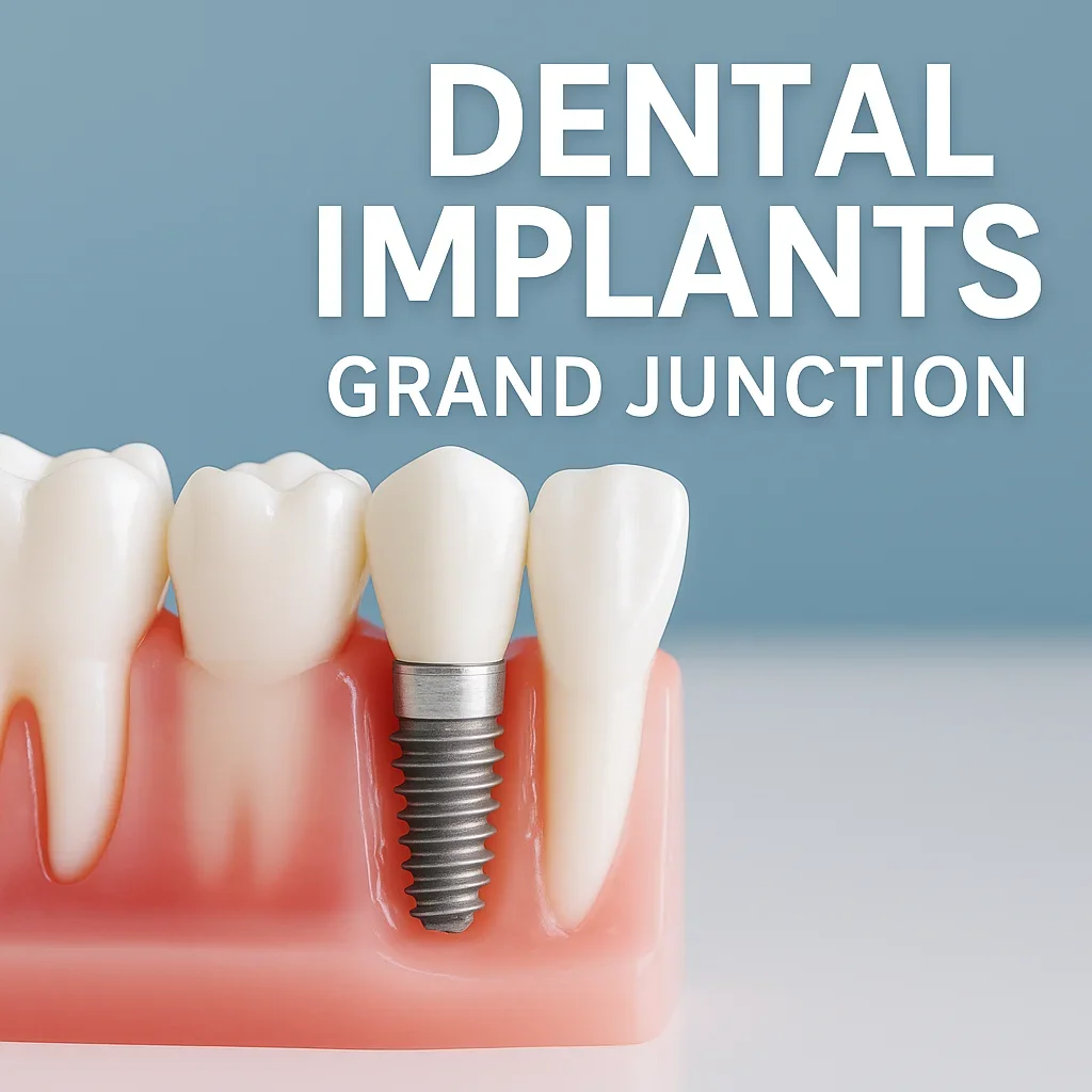 Dental Implants Grand Junction: Restore Your Smile with Confidence 5 dental implants grand junction