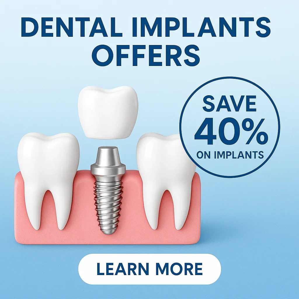 Best Dental Implants Offers for Perfect Smiles 5 dental implants offers