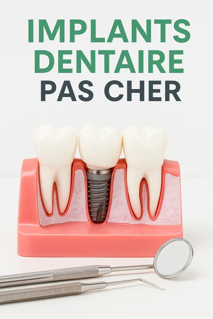 Implants dentaire pas cher : guide complet pour un nouveau sourire 4 implants dentaire pas cher