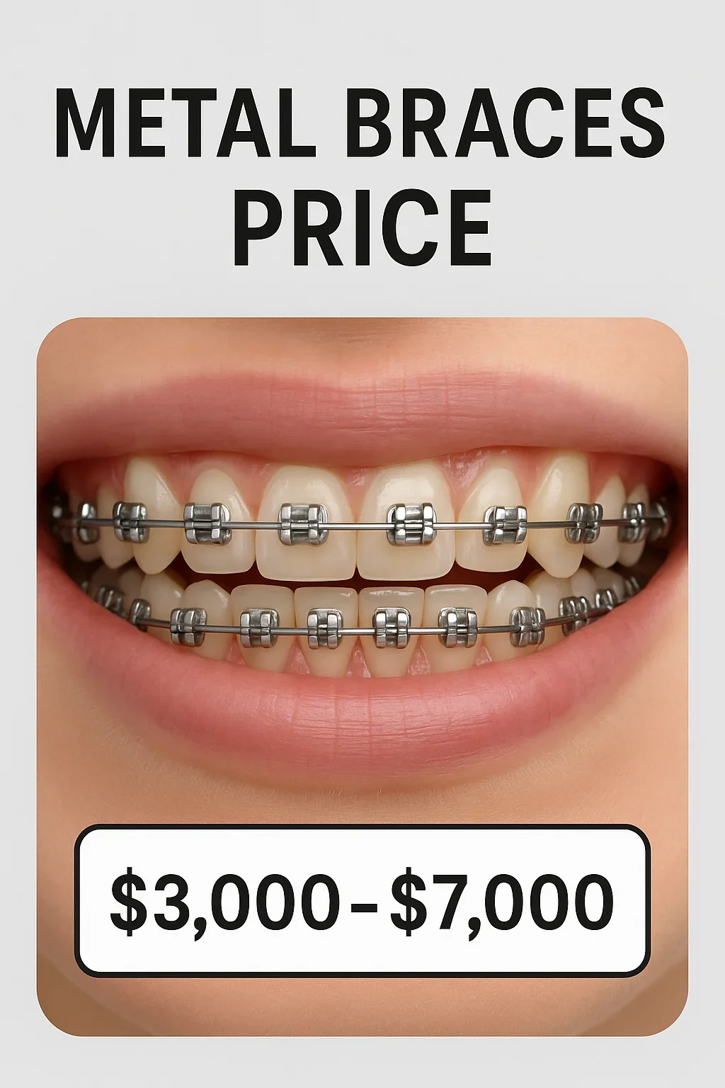Metal Braces Price: Complete Guide to Costs, Options, and Savings 5 metal braces price