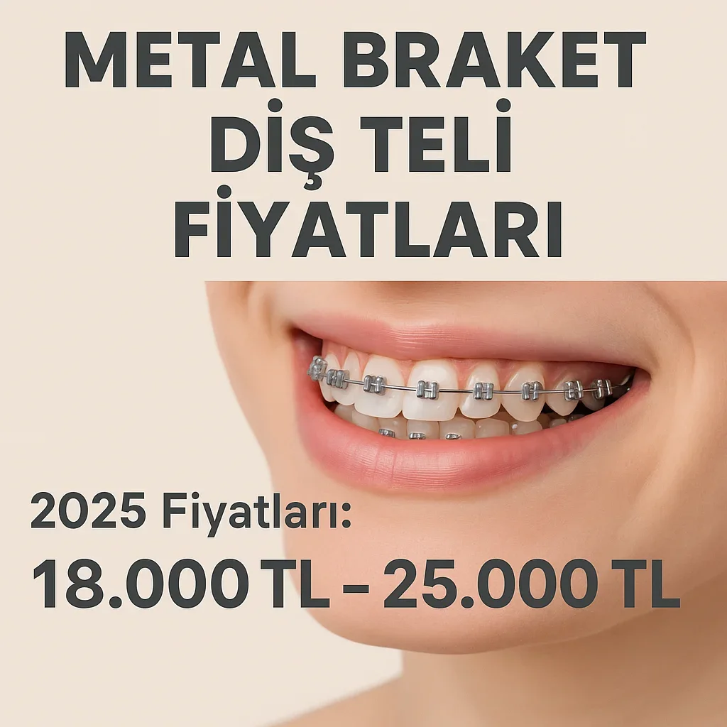 Metal Braket Diş Teli Fiyatları 2025: Güncel Liste ve Tedavi Rehberi 5 metal braket dis teli fiyatlari