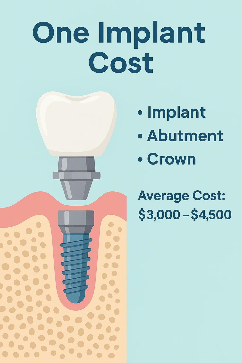 One Implant Cost: Complete Guide to 2025 Prices 5 one implant cost