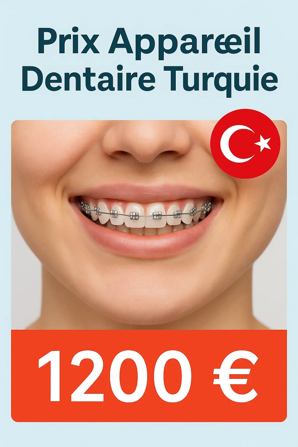 Prix appareil dentaire Turquie : tout ce qu’il faut savoir avant de se lancer 5 prix appareil dentaire turquie