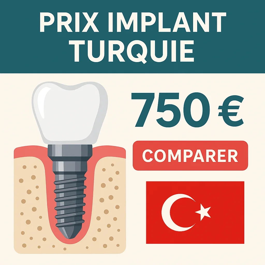 Prix implant Turquie : Tout savoir avant de se lancer 5 prix implant turquie