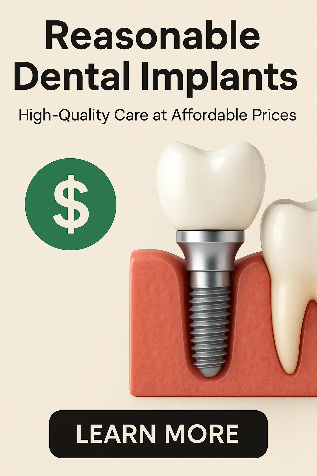 reasonable dental implants