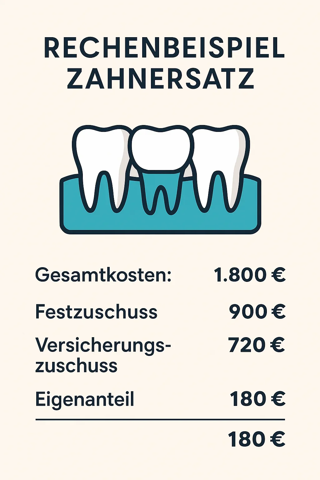 Rechenbeispiel Zahnersatz: So berechnen Sie Ihre tatsächlichen Kosten 5 rechenbeispiel zahnersatz