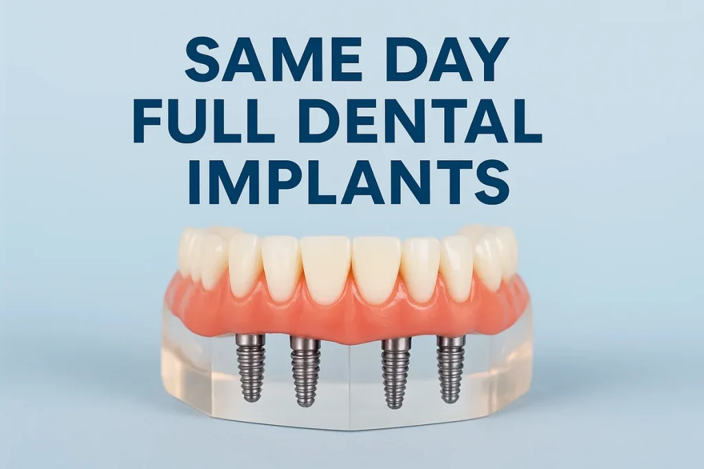Same Day Full Dental Implants: The Ultimate Guide to a New Smile 4 same day full dental implants