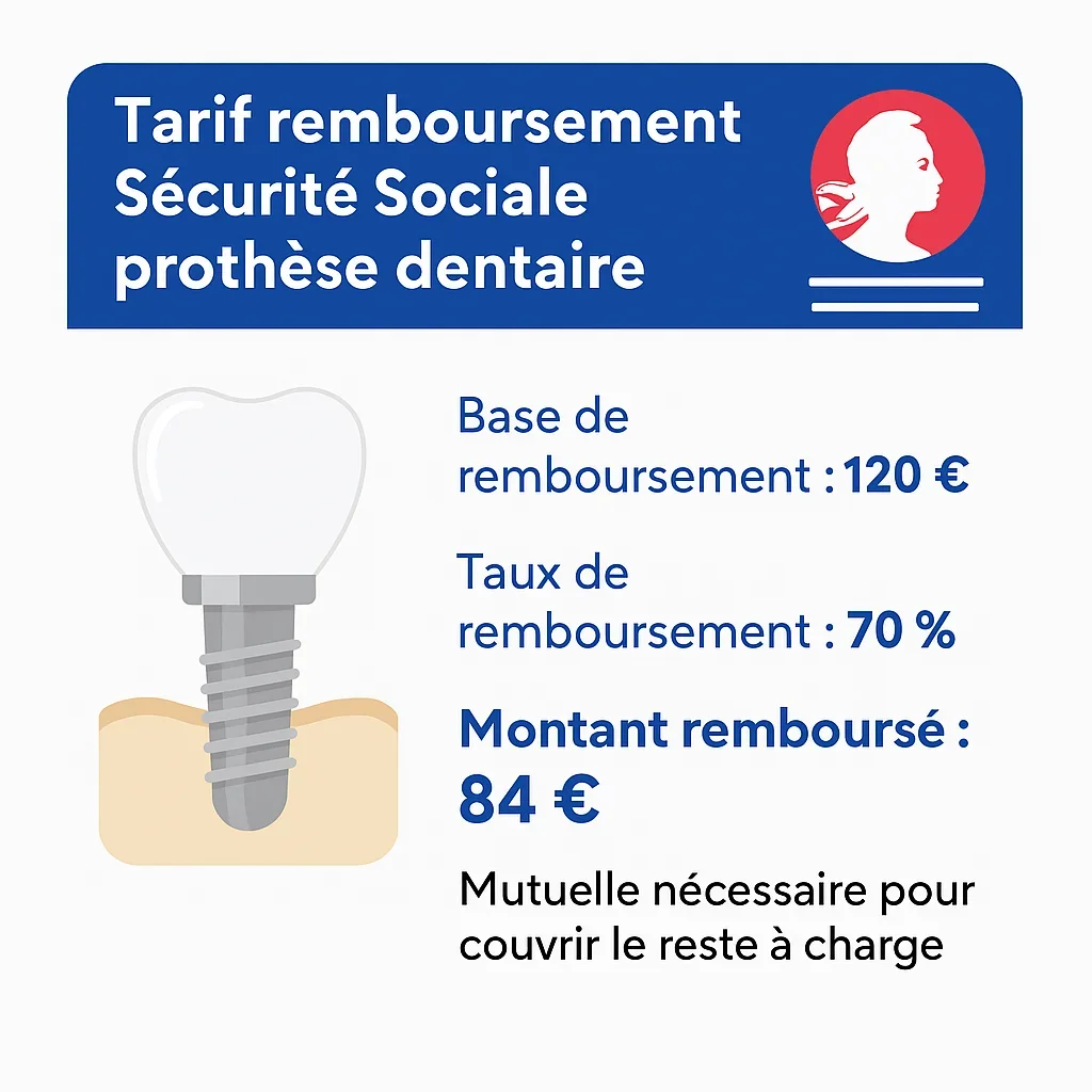Tarif remboursement Sécurité sociale prothèse dentaire : guide complet 5 tarif remboursement securite sociale prothese dentaire