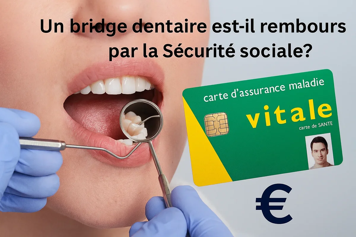 un bridge dentaire est il rembourse par la securite sociale