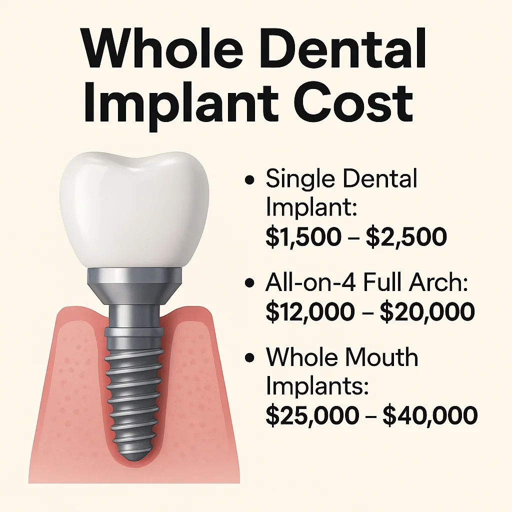 Whole Dental Implant Cost: Complete Guide for 2025 🦷 5 whole dental implant cost