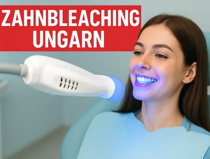 Zahnbleaching Ungarn – So erhalten Sie Ihr strahlendstes Lächeln 12 zahnbleaching ungarn