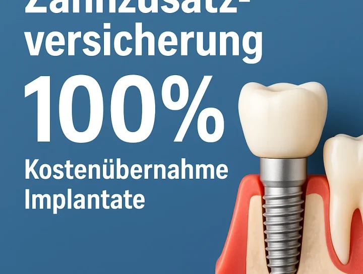 zahnzusatzversicherung 100 kostenübernahme implantate