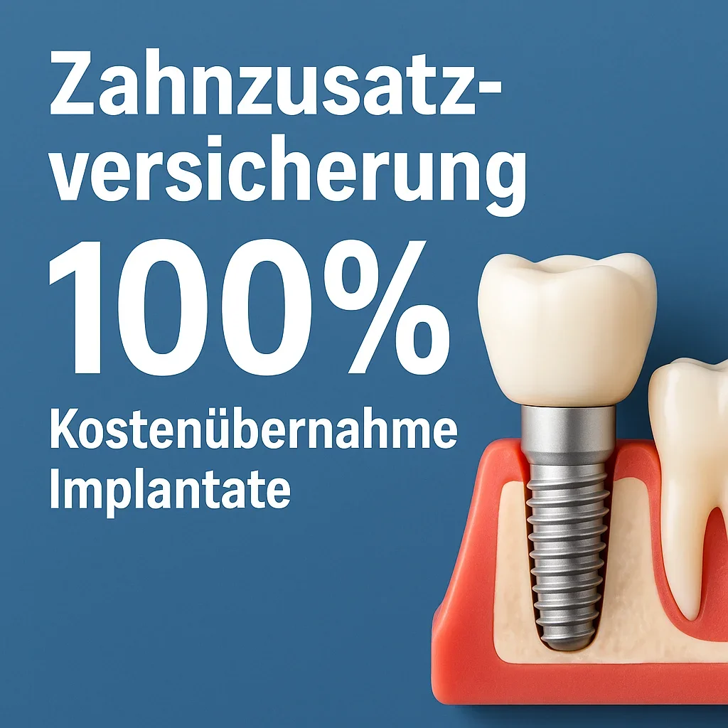 Zahnzusatzversicherung 100 Kostenübernahme Implantate – Ihr kompletter Leitfaden 5 zahnzusatzversicherung 100 kostenübernahme implantate