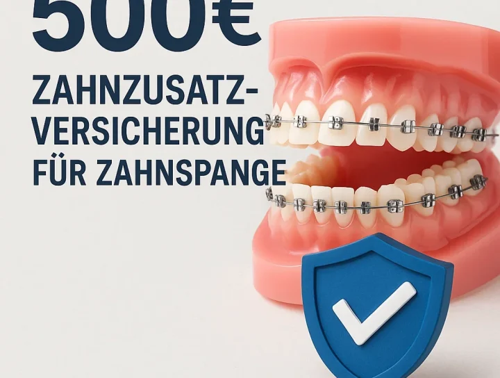 Zahnzusatzversicherung für Zahnspange: Alles, was Sie wissen müssen 16 zahnzusatzversicherung für zahnspange