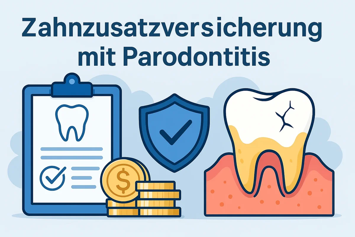 Zahnzusatzversicherung mit Parodontitis – das sollten Sie wissen 5 zahnzusatzversicherung mit parodontitis