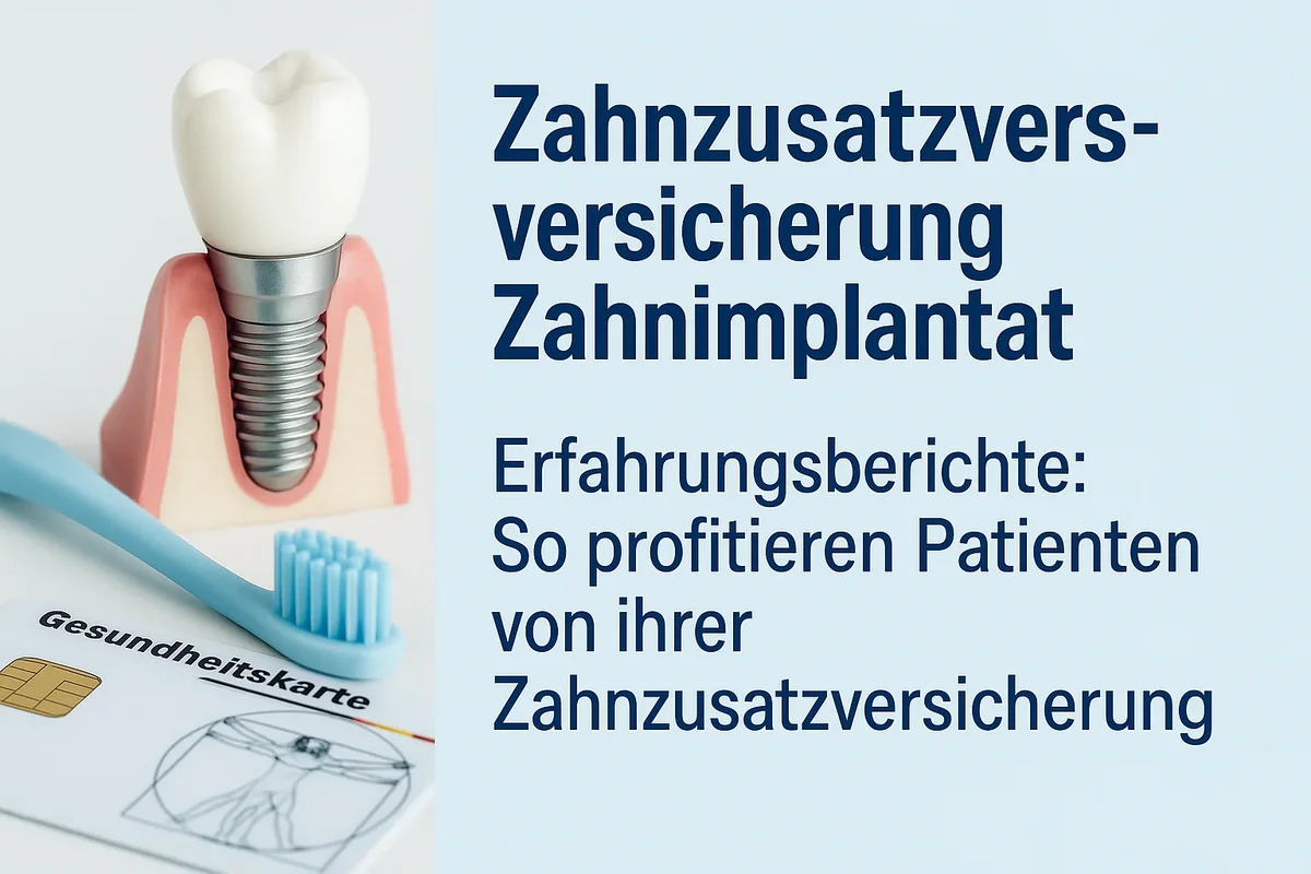 Zahnzusatzversicherung Zahnimplantat – Lohnt sich der Schutz wirklich? 5 zahnzusatzversicherung zahnimplantat