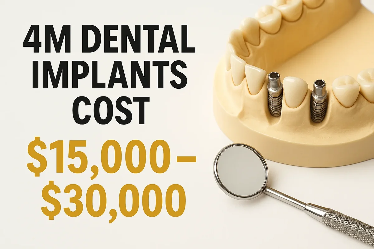 4m dental implants cost