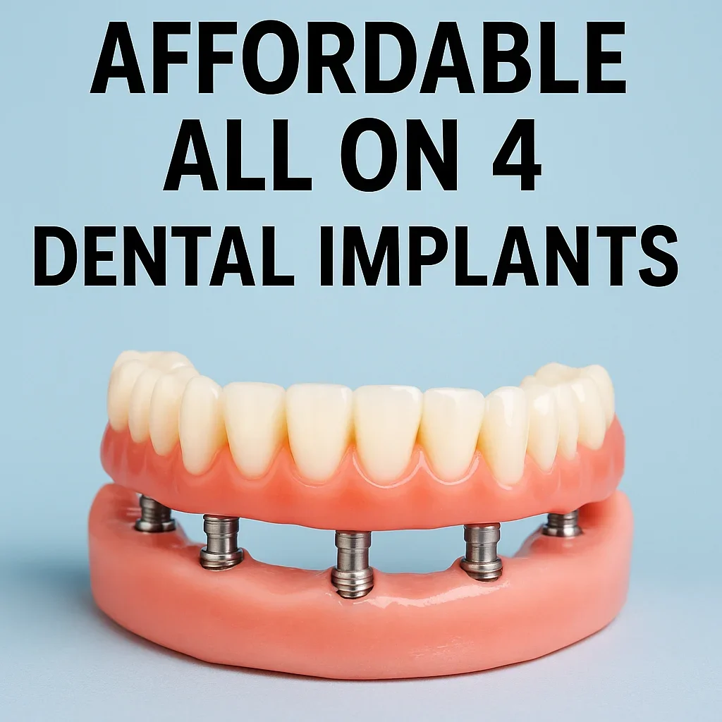 Affordable All on 4 Dental Implants: Complete Patient Guide 5 affordable all on 4 dental implants