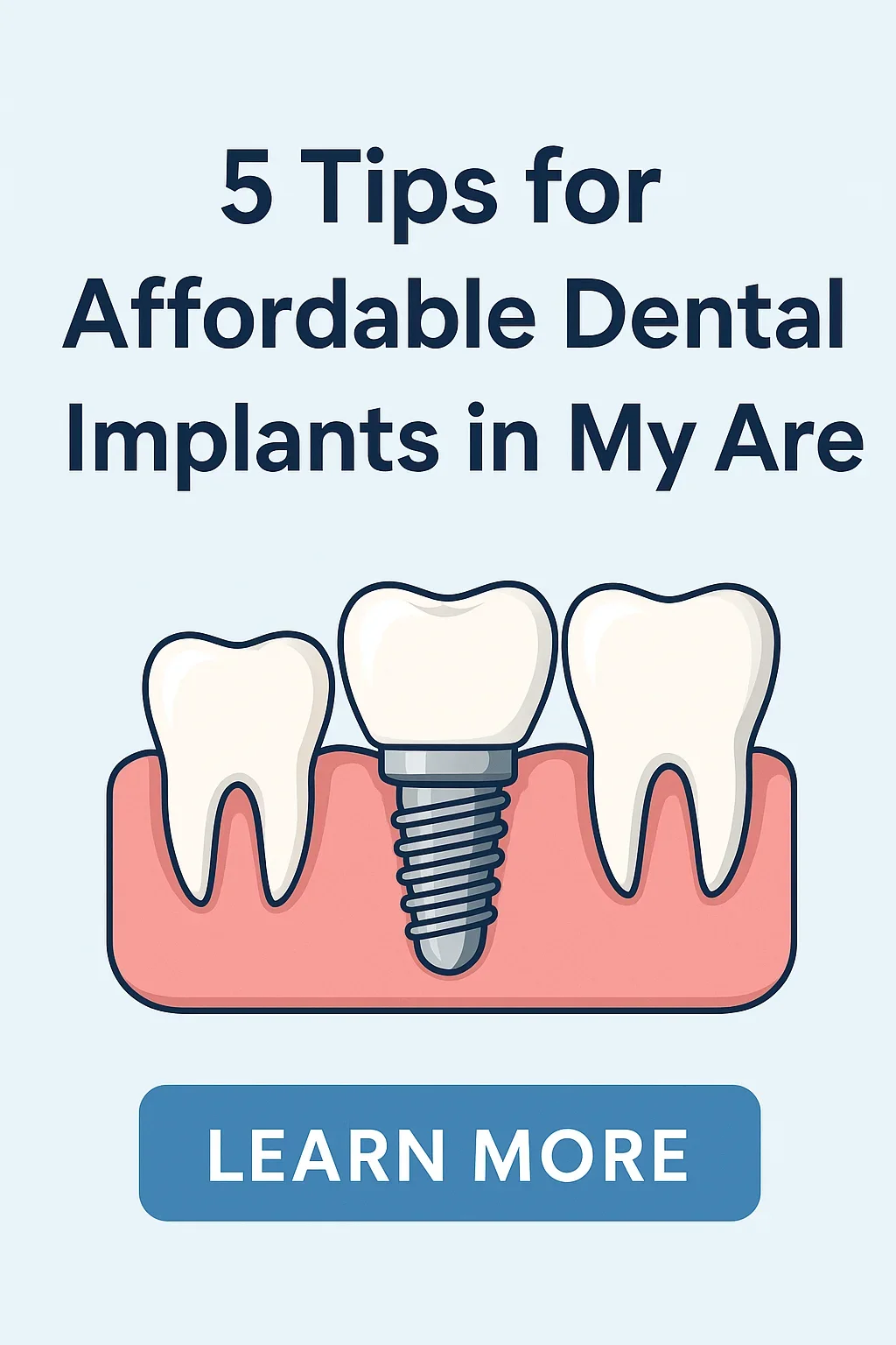 affordable dental implants in my area