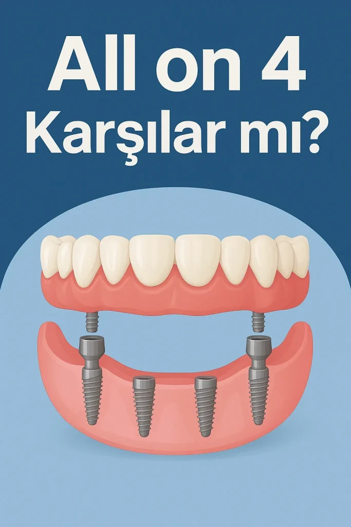 All on 4 Karşılar mı? Diş Kaybı Tedavisinde Yeni Dönem 4 all on 4 karsilar mi