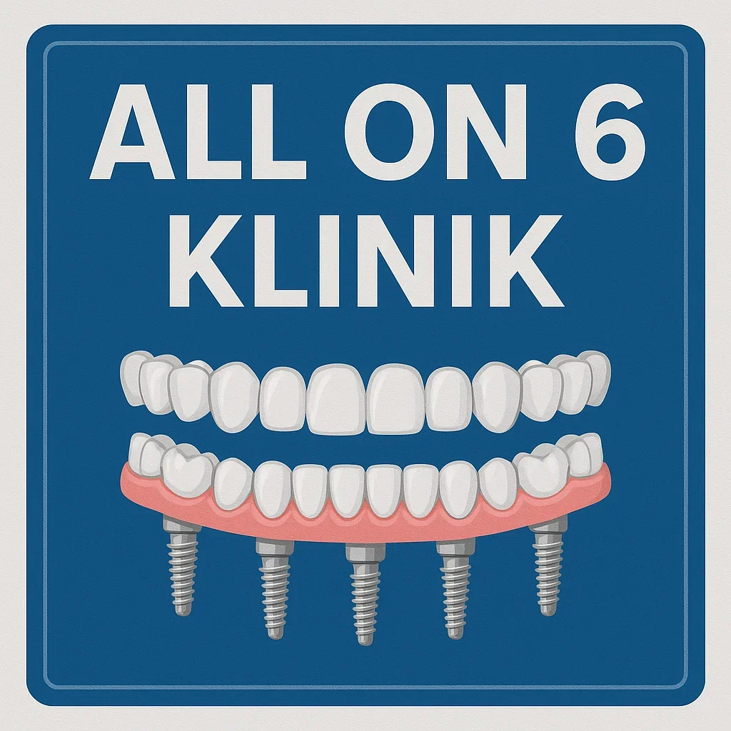 All on 6 Klinik Tedavisi Nedir? Aşamaları ve Uygulama Süreci 5 all on 6 klinik