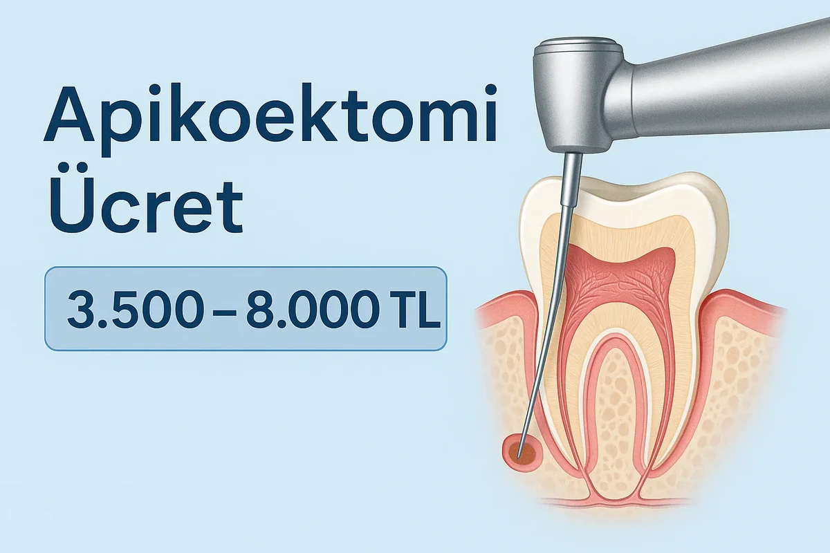 apikoektomi ucret