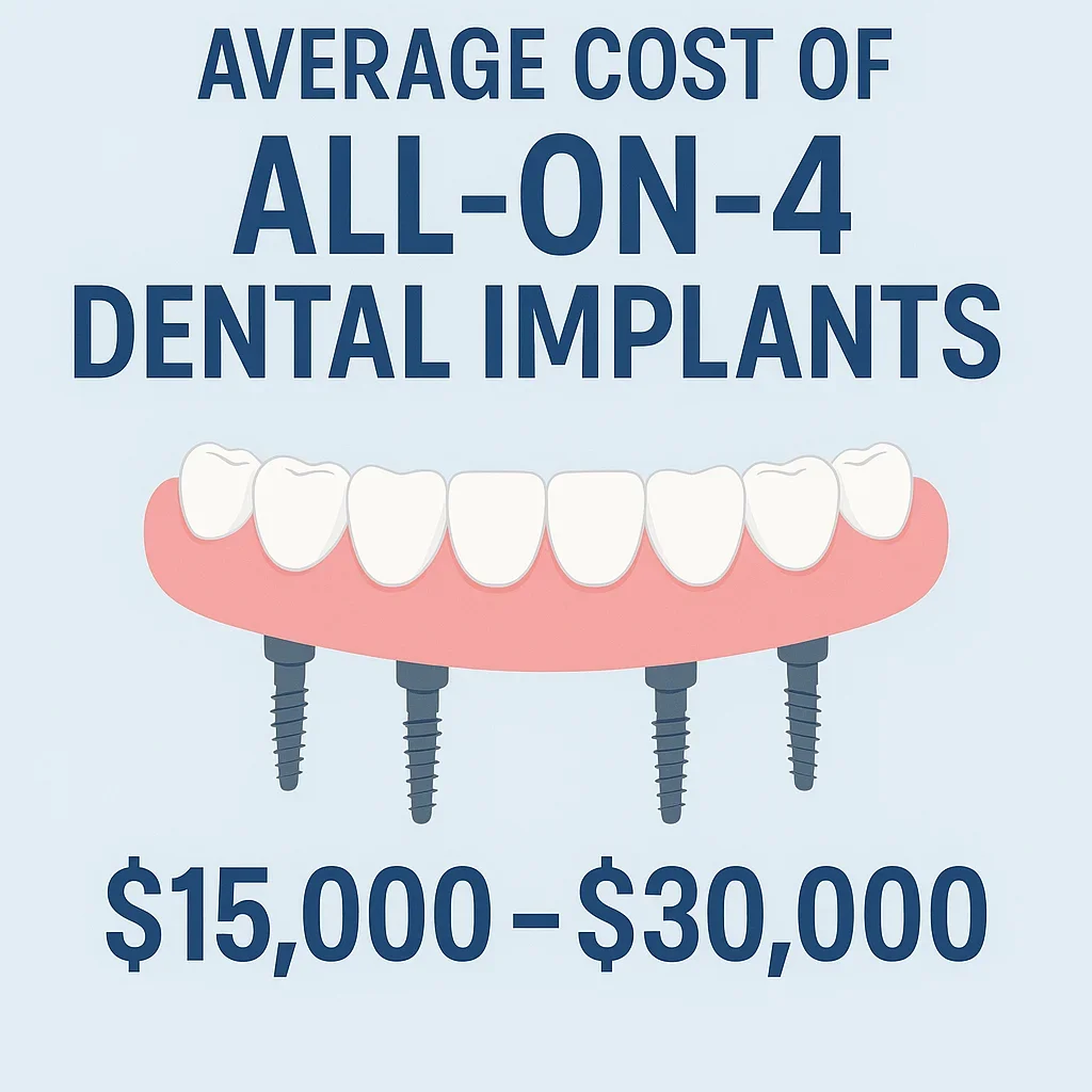 Average Cost of All on 4 Dental Implants: 2025 Complete Guide 5 average cost of all on 4 dental implants