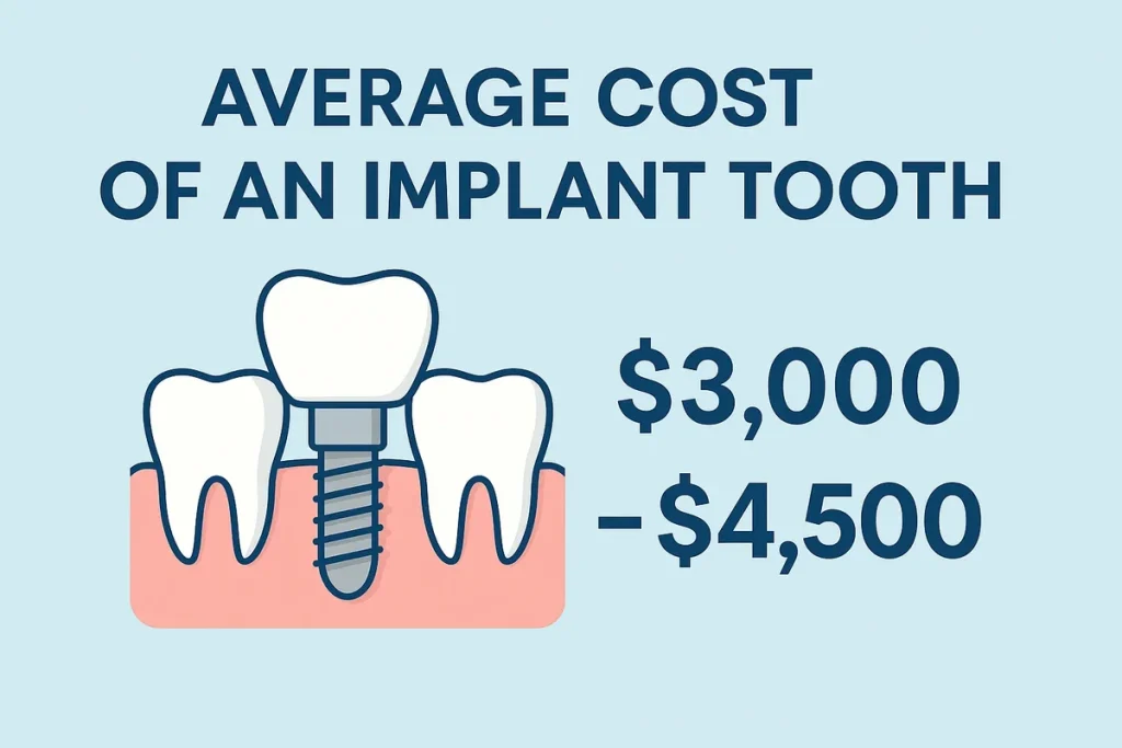 Average Cost of an Implant Tooth: Complete Guide 4 average cost of an implant tooth