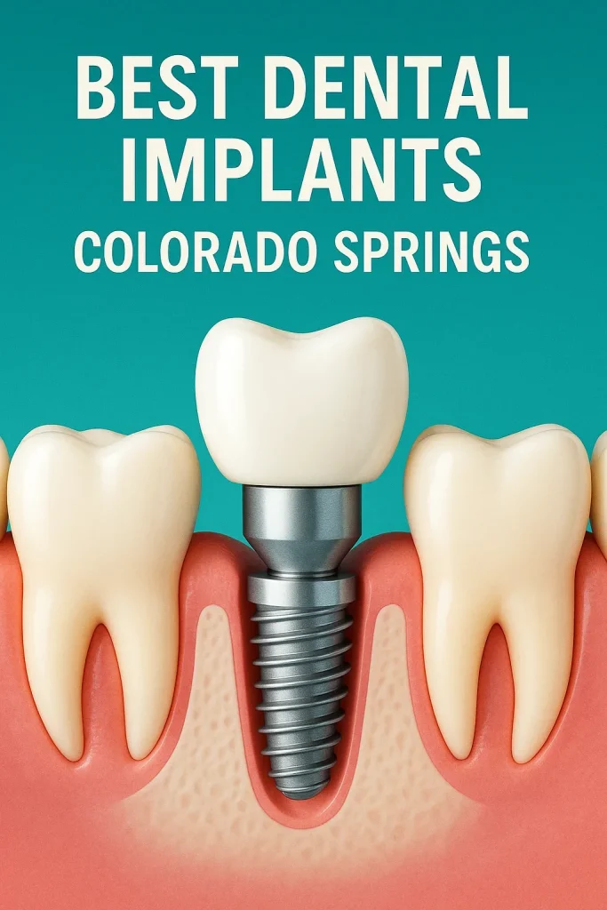 Best Dental Implants Colorado Springs 4 best dental implants colorado springs