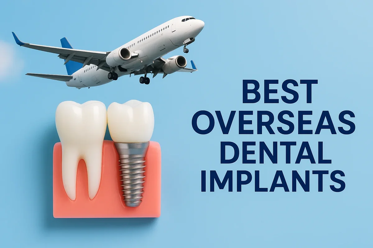 Best Overseas Dental Implants: Full Global Patient Guide 5 best overseas dental implants