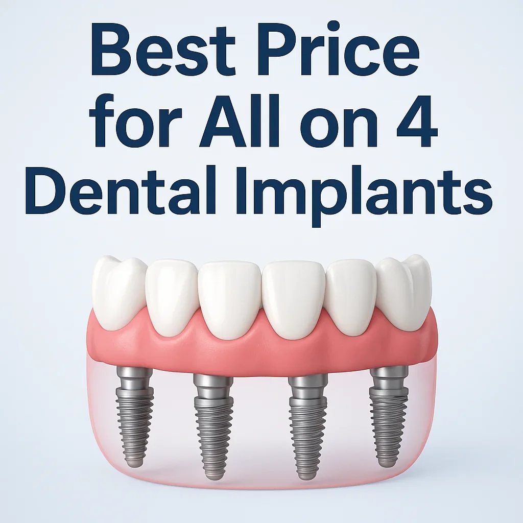Best Price for All on 4 Dental Implants 5 best price for all on 4 dental implants