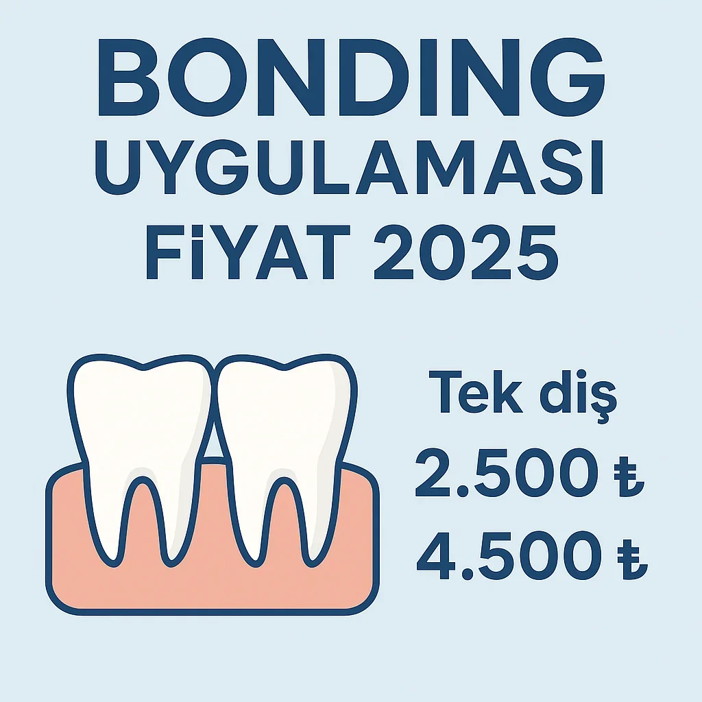 Bonding Uygulaması Fiyat 2025: Estetik Gülüş İçin Güncel Bilgiler 5 bonding uygulamasi fiyat 2025