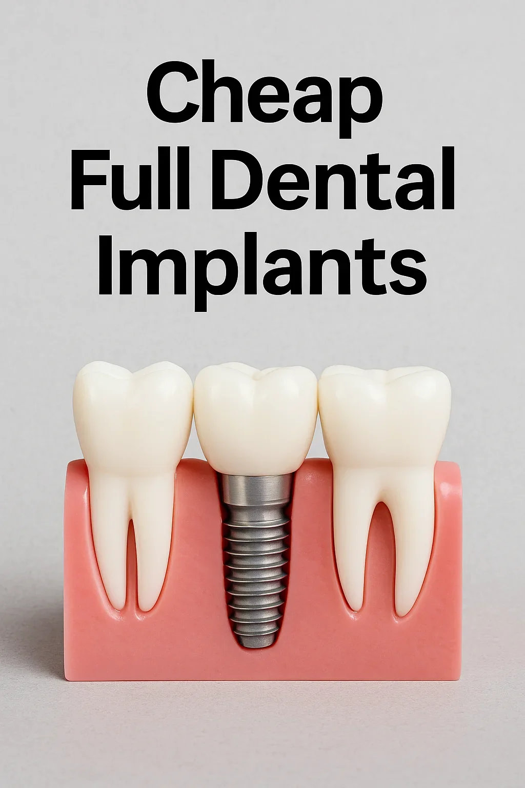cheap full dental implants