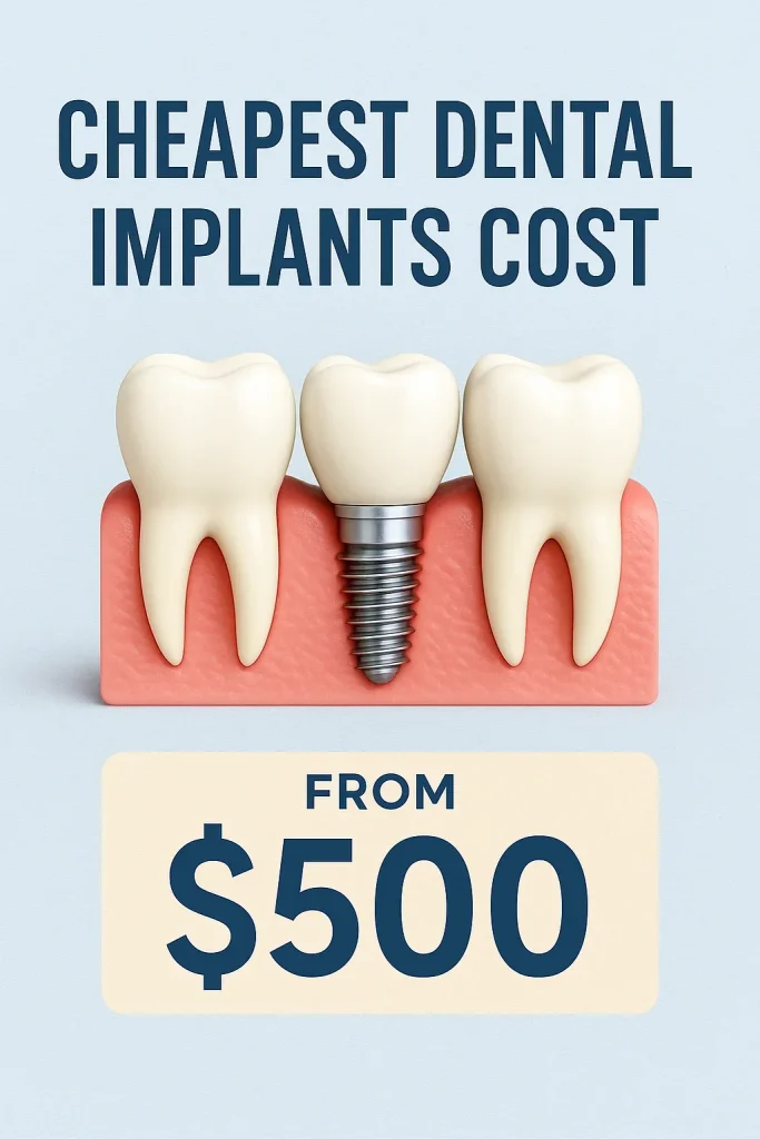Cheapest Dental Implants Cost: Complete 2025 Guide đ 4 cheapest dental implants cost