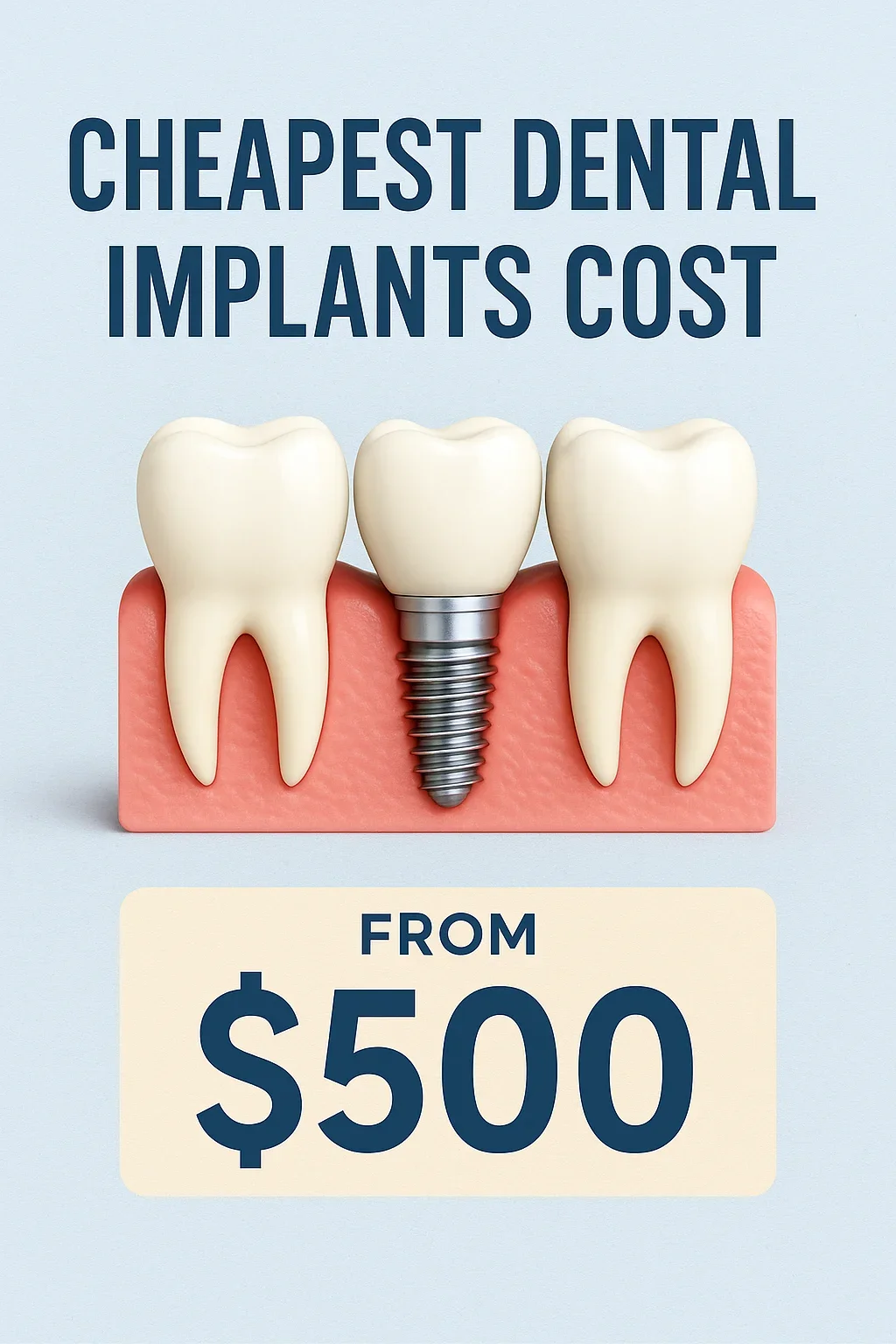 Cheapest Dental Implants Cost: Complete 2025 Guide đ 5 cheapest dental implants cost
