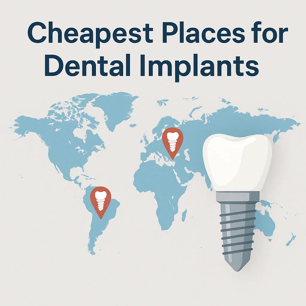 Cheapest Places for Dental Implants: Global Cost Breakdown 5 cheapest places for dental implants