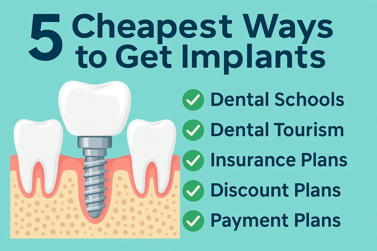 Cheapest Way to Get Implants: Complete 2025 Guide 5 cheapest way to get implants