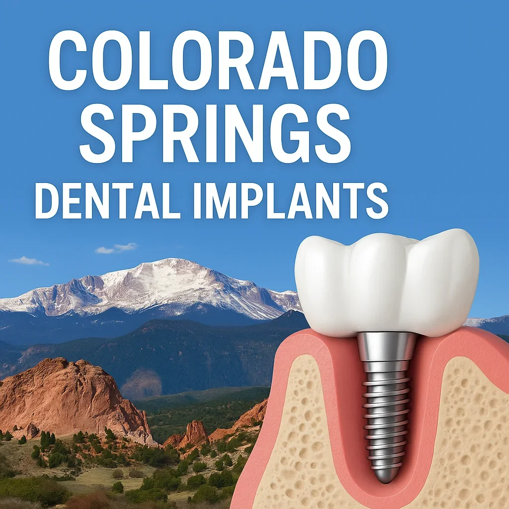 Colorado Springs Dental Implants: Complete Patient Guide 5 colorado springs dental implants
