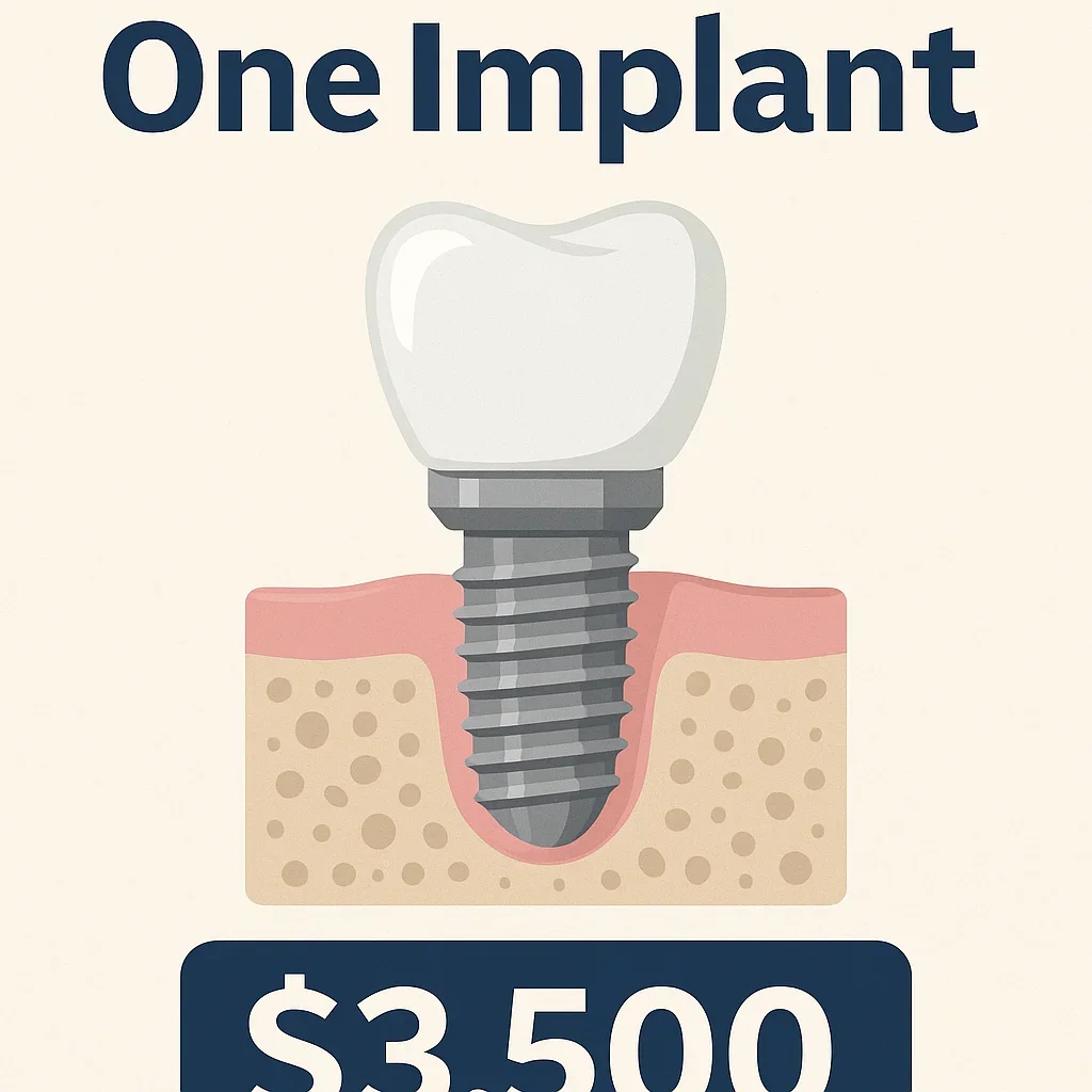 Cost of One Implant: Full Guide to 2025 Prices and Factors 5 cost of one implant