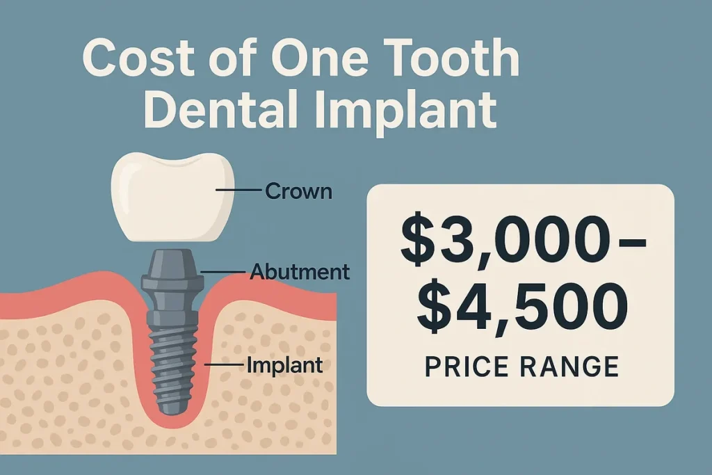 Understanding the Cost of One Tooth Dental Implant: Complete 2025 Guide 4 cost of one tooth dental implant