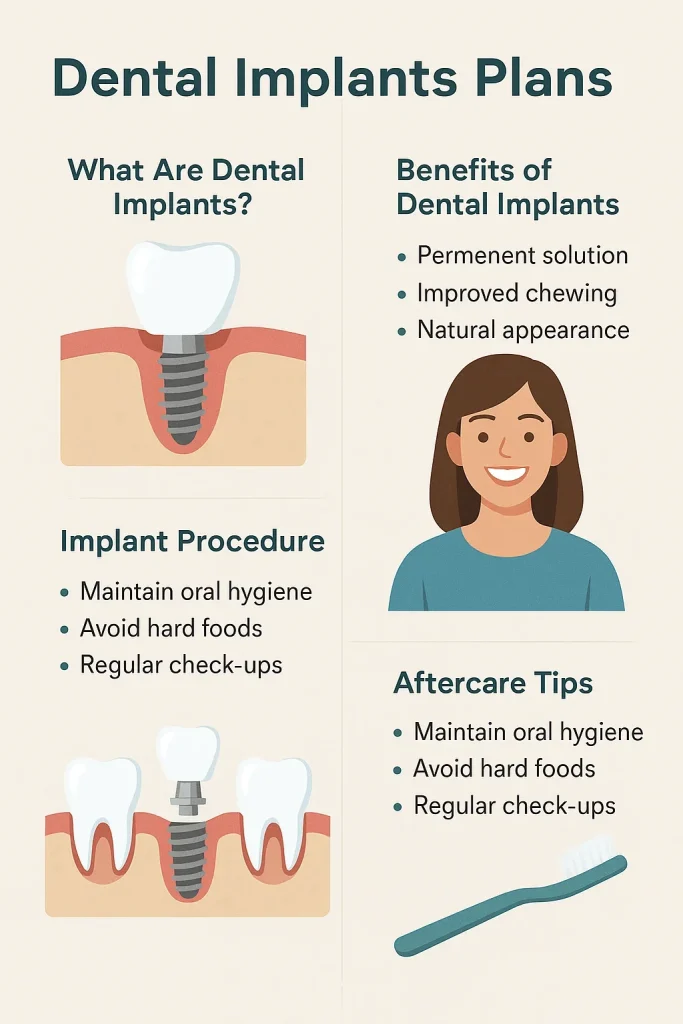 Dental Implants Plans: Your Complete Guide to a Confident Smile 4 dental implants plans
